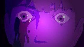 Sclera